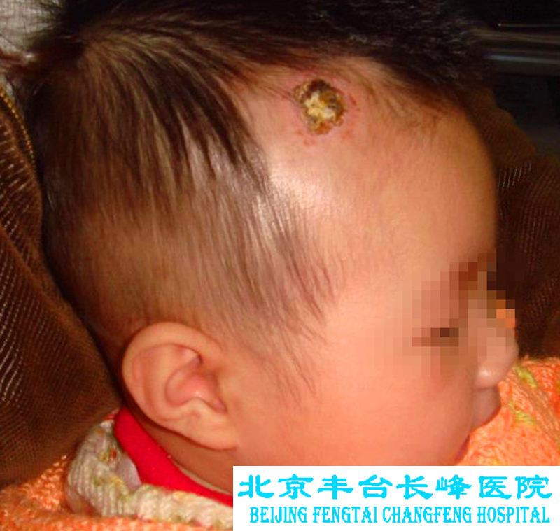 男科图片