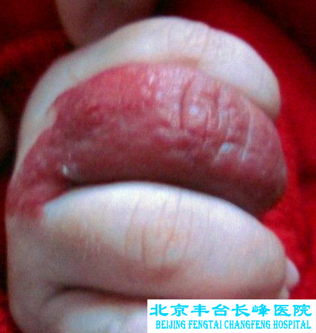 妇科图片