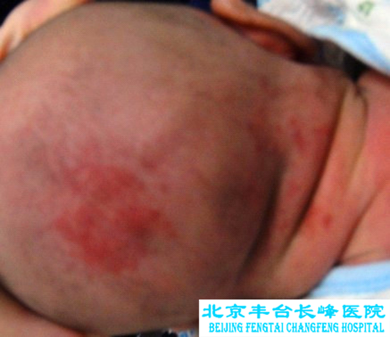 妇科图片