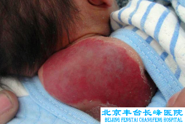 妇科图片