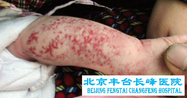 妇科图片