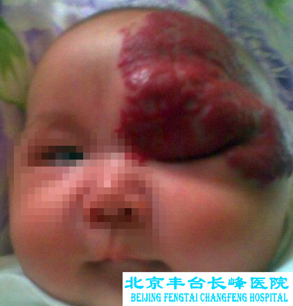 妇科|妇科图片|妇科症状|妇科危害|妇科治疗|流产保胎状妇科|先兆流产状妇科|产后漏尿|药物流产|外阴白斑|习惯性流产|混合型妇科|人流常识|宫颈糜烂|婴幼儿妇科|婴儿妇科|小儿妇科|宫颈息肉|宫颈囊肿|无痛人流|宫颈肥大|宫外孕