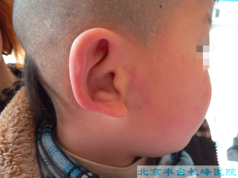 妇科|妇科图片|妇科症状|妇科危害|妇科治疗|流产保胎状妇科|先兆流产状妇科|产后漏尿|药物流产|外阴白斑|习惯性流产|混合型妇科|人流常识|宫颈糜烂|婴幼儿妇科|婴儿妇科|小儿妇科|宫颈息肉|宫颈囊肿|无痛人流|宫颈肥大|宫外孕