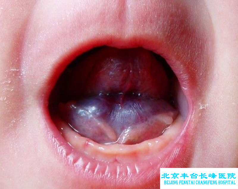 妇科|妇科图片|妇科症状|妇科危害|妇科治疗|流产保胎状妇科|先兆流产状妇科|产后漏尿|药物流产|外阴白斑|习惯性流产|混合型妇科|人流常识|宫颈糜烂|婴幼儿妇科|婴儿妇科|小儿妇科|宫颈息肉|宫颈囊肿|无痛人流|宫颈肥大|宫外孕