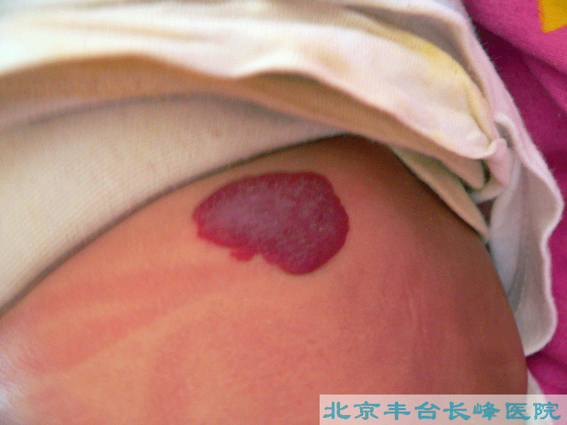 男科|男科图片|男科症状|男科危害|男科治疗|流产保胎状男科|先兆流产状男科|产后漏尿|药物流产|外阴白斑|习惯性流产|混合型男科|包皮常识|宫颈糜烂|婴幼儿男科|婴儿男科|小儿男科|宫颈息肉|宫颈囊肿|无痛包皮|宫颈肥大|宫外孕