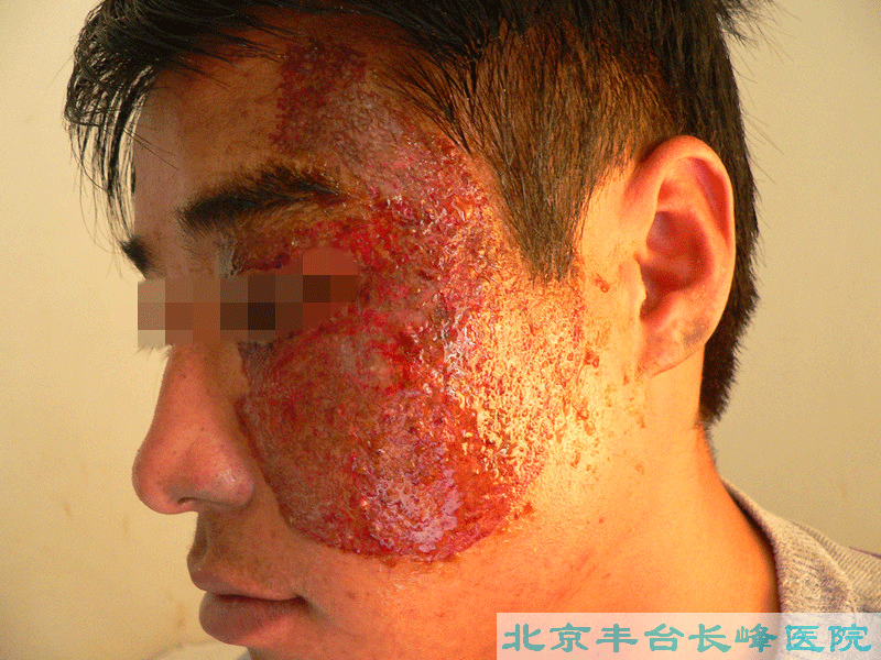妇科|妇科图片|妇科症状|妇科危害|妇科治疗|流产保胎状妇科|先兆流产状妇科|产后漏尿|药物流产|外阴白斑|习惯性流产|混合型妇科|人流常识|宫颈糜烂|婴幼儿妇科|婴儿妇科|小儿妇科|宫颈息肉|宫颈囊肿|无痛人流|宫颈肥大|宫外孕