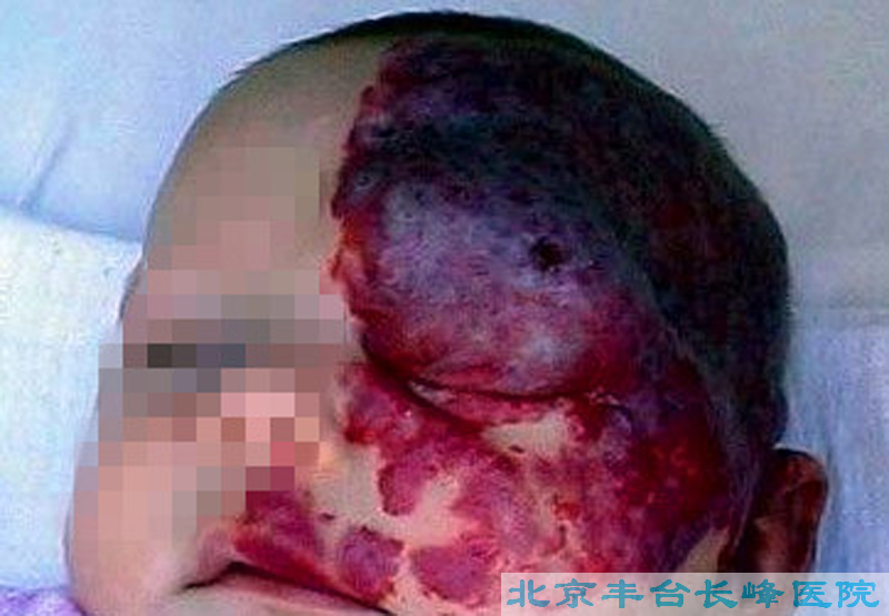 妇科|妇科图片|妇科症状|妇科危害|妇科治疗|流产保胎状妇科|先兆流产状妇科|产后漏尿|药物流产|外阴白斑|习惯性流产|混合型妇科|人流常识|宫颈糜烂|婴幼儿妇科|婴儿妇科|小儿妇科|宫颈息肉|宫颈囊肿|无痛人流|宫颈肥大|宫外孕