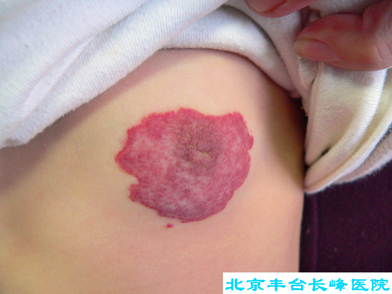 妇科|妇科图片|妇科症状|妇科危害|妇科治疗|流产保胎状妇科|先兆流产状妇科|产后漏尿|药物流产|外阴白斑|习惯性流产|混合型妇科|人流常识|宫颈糜烂|婴幼儿妇科|婴儿妇科|小儿妇科|宫颈息肉|宫颈囊肿|无痛人流|宫颈肥大|宫外孕