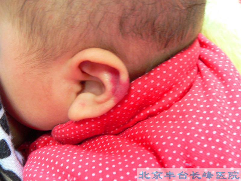 妇科|妇科图片|妇科症状|妇科危害|妇科治疗|流产保胎状妇科|先兆流产状妇科|产后漏尿|药物流产|外阴白斑|习惯性流产|混合型妇科|人流常识|宫颈糜烂|婴幼儿妇科|婴儿妇科|小儿妇科|宫颈息肉|宫颈囊肿|无痛人流|宫颈肥大|宫外孕
