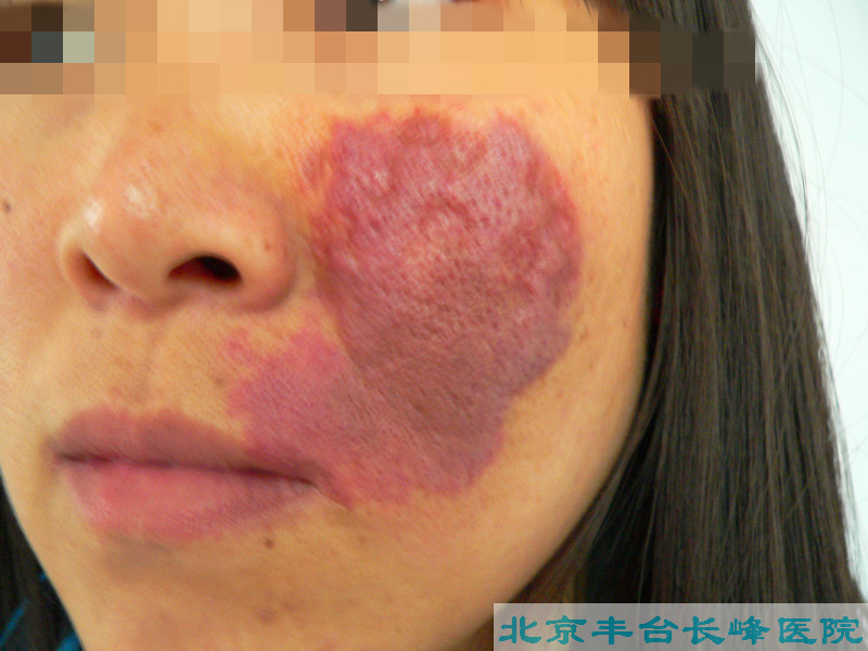 妇科|妇科图片|妇科症状|妇科危害|妇科治疗|流产保胎状妇科|先兆流产状妇科|产后漏尿|药物流产|外阴白斑|习惯性流产|混合型妇科|人流常识|宫颈糜烂|婴幼儿妇科|婴儿妇科|小儿妇科|宫颈息肉|宫颈囊肿|无痛人流|宫颈肥大|宫外孕