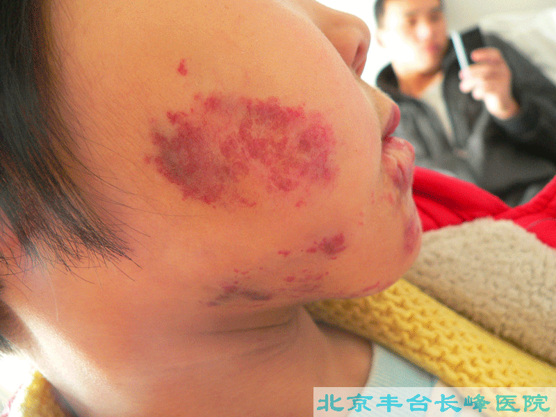 妇科|妇科图片|妇科症状|妇科危害|妇科治疗|流产保胎状妇科|先兆流产状妇科|产后漏尿|药物流产|外阴白斑|习惯性流产|混合型妇科|人流常识|宫颈糜烂|婴幼儿妇科|婴儿妇科|小儿妇科|宫颈息肉|宫颈囊肿|无痛人流|宫颈肥大|宫外孕