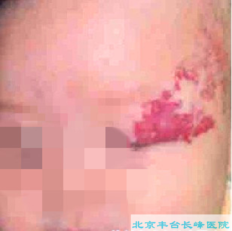 妇科|妇科图片|妇科症状|妇科危害|妇科治疗|流产保胎状妇科|先兆流产状妇科|产后漏尿|药物流产|外阴白斑|习惯性流产|混合型妇科|人流常识|宫颈糜烂|婴幼儿妇科|婴儿妇科|小儿妇科|宫颈息肉|宫颈囊肿|无痛人流|宫颈肥大|宫外孕